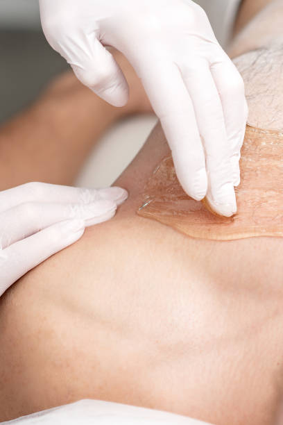 istock Epilation chest of young male 1270575185