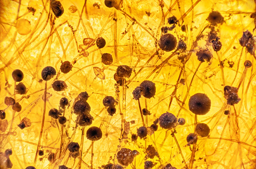 Mold fungus in microscope.