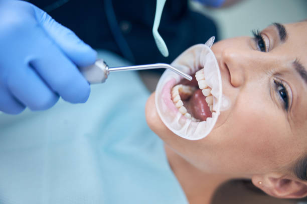 istock Young woman having teeth treated in clinic 1270675595