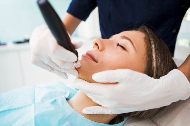 istock Dermapen skin needling treatment 1270680670