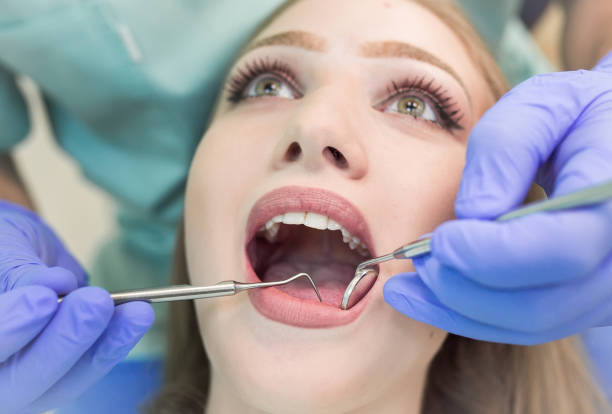 istock Dentist doing procedure with dental curing UV light in clinic 1270687935
