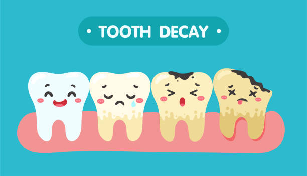 Cartoon teeth and gums inside the mouth are happy with the problem of tooth decay. There are plaque on the teeth. Cartoon teeth and gums inside the mouth are happy with the problem of tooth decay. There are plaque on the teeth. bad teeth stock illustrations