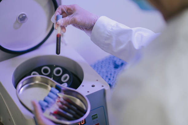 美容師は、血液採取管を保持する遠心分離機機を使用して血小板豊富な血漿療法に取り組むprp療法アジアの中国人看護師を行います - vial laboratory test tube biotechnology ストックフォトと画像