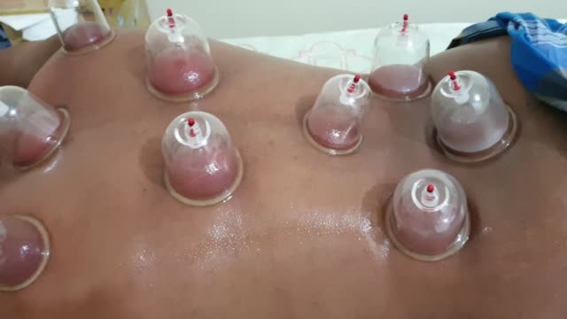 Background image of cupping done in a body.