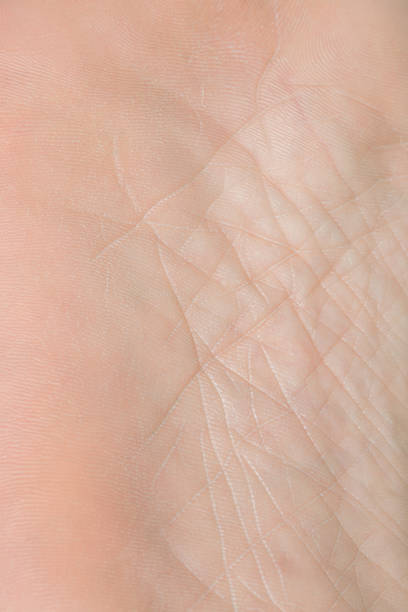 istock Human skin close up background 1270990645