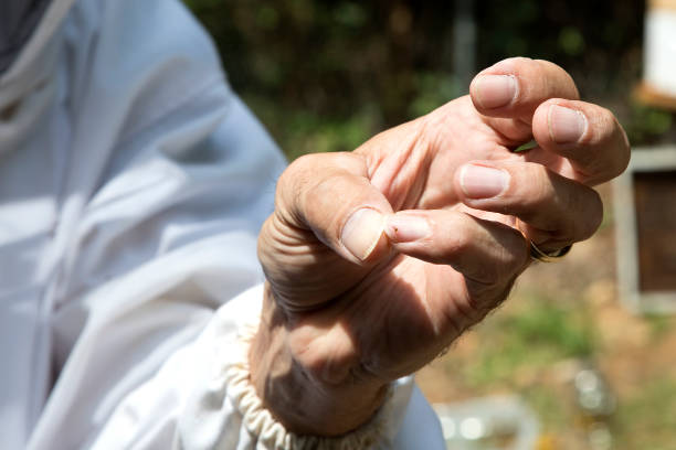 istock Honey Bee stinger on fingernail 1270997522