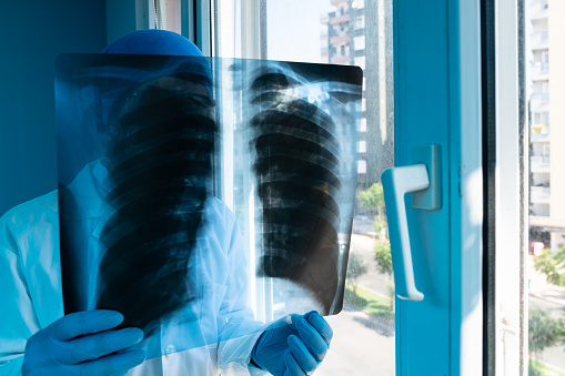 Doctor holding medical x-ray image of lung in front of window and analyzing. He is wearing protective face mask, surgical gloves and lab coat. Shot indoor with a full frame mirrorless camera.