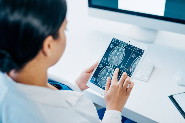 She's a specialist at treating diseases of the brain Shot of a young doctor analysing brain scans on a digital tablet neurosurgery photos stock pictures, royalty-free photos & images
