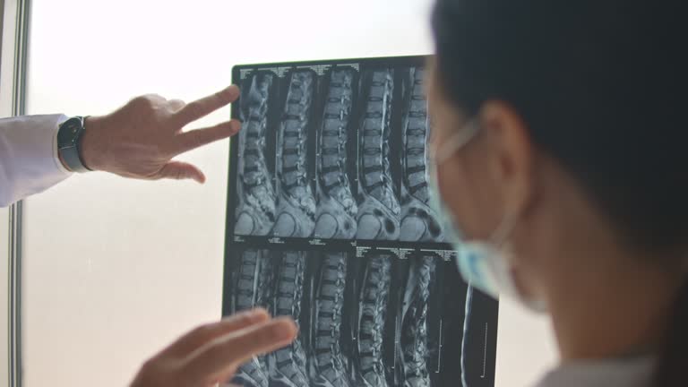 Doctors examining a patient's x-ray and discussing