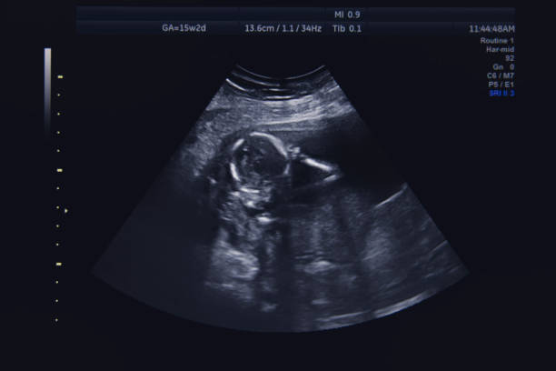 istock Baby Ultra Sound 1271415396