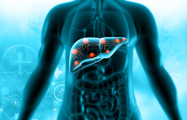 인간의 간바이러스 공격 - macrophage human immune system cell biology 뉴스 사진 이미지