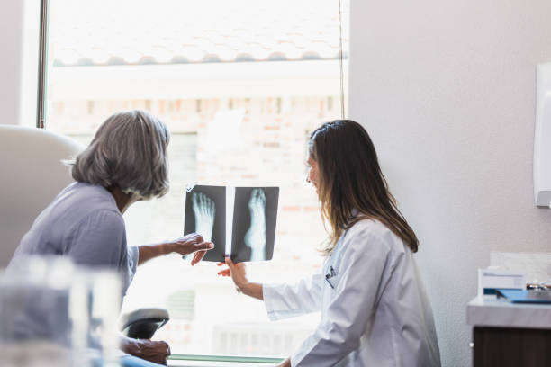 senior woman talks with doctor about foot x-ray - x ray image radiologist examining using voice imagens e fotografias de stock