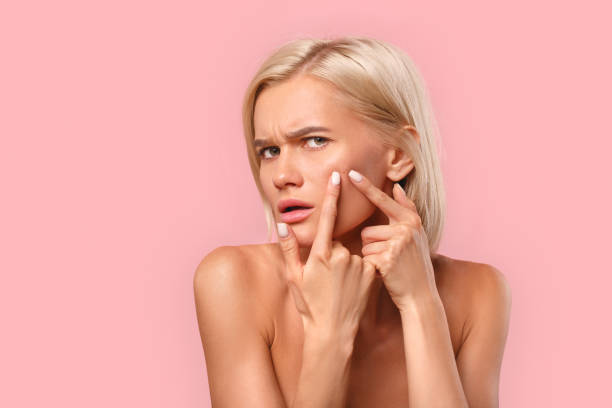 istock Young adult women with problem skin looking at camera 1271624858