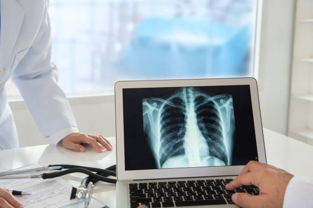 radiologist examining lungs x-ray - x ray image radiologist examining using voice imagens e fotografias de stock