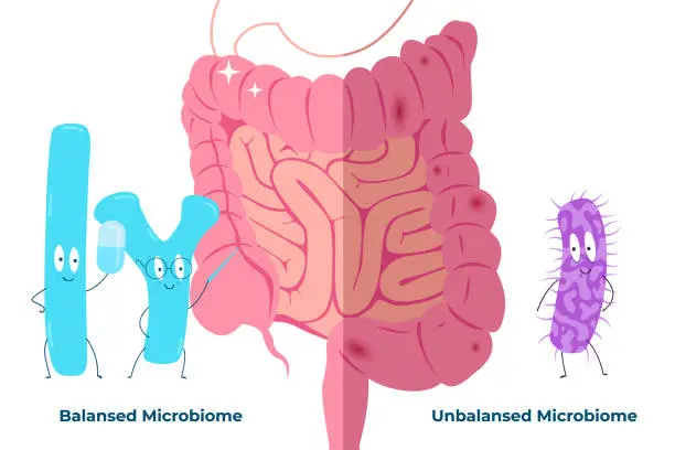 Vector illustration of Bad and good bacteria on the background of the intestine. How bad and good bacteria affect the gut. Editable vector illustration.