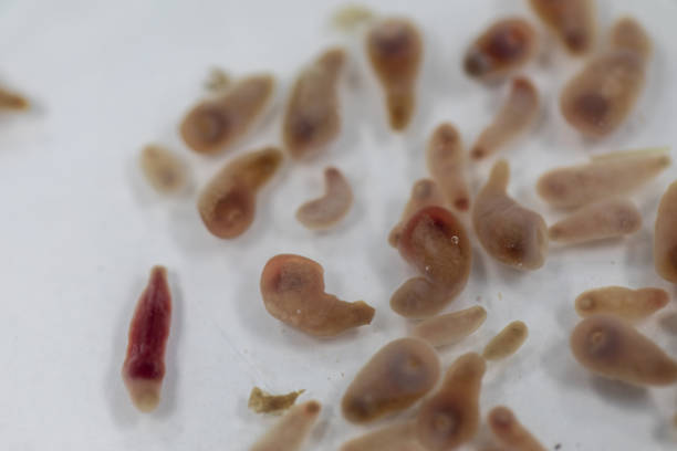 istock The study parasite or worms is a freshwater fish parasite in laboratory for education. 1271689645