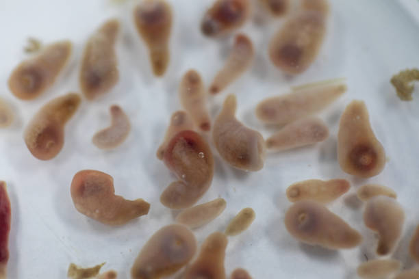 istock The study parasite or worms is a freshwater fish parasite in laboratory for education. 1271689651
