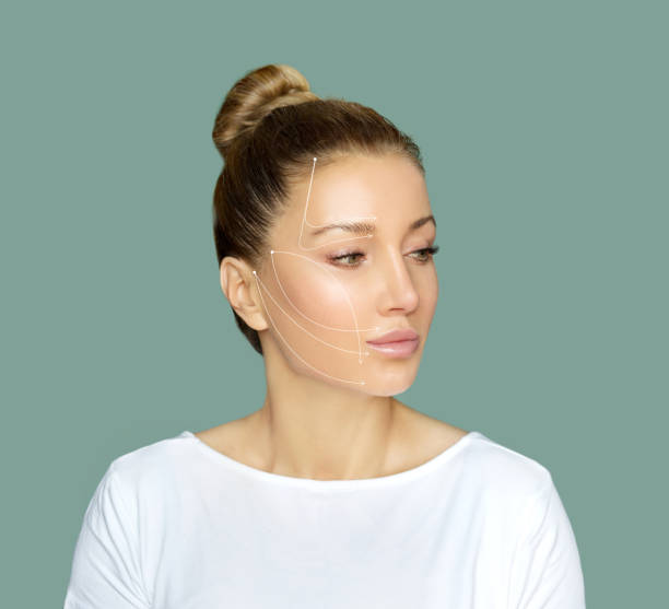 istock thread lift procedure ,non-surgical facelift,markup 1271711865
