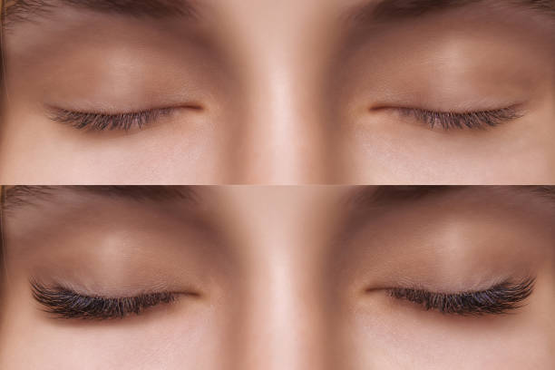 istock Eyelash Extension. Comparison of female eyes before and after 1271748244
