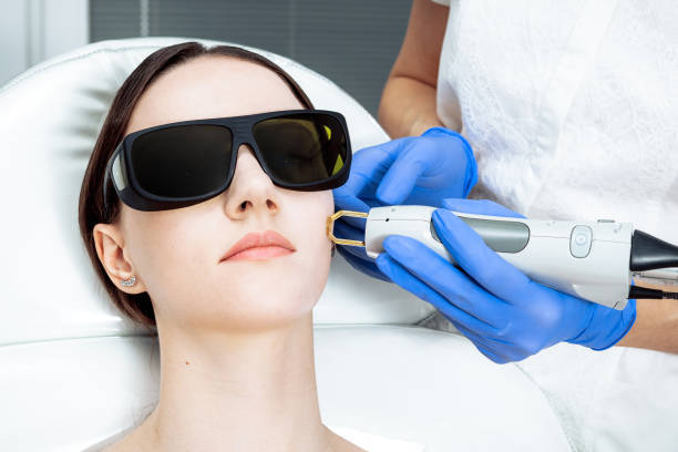 Woman Receiving Facial Beauty Treatment, Removing Pigmentation photo Intense Pulsed Light Therapy. IPL. Anti-aging Woman Receiving Facial Beauty Treatment Removing Pigmentation At Cosmetic Clinic. Intense Pulsed Light Therapy Rejuvenation. Laser cosmetology blond doctor and patient wearing black protection glasses beauty treatment photos stock pictures, royalty-free photos & images