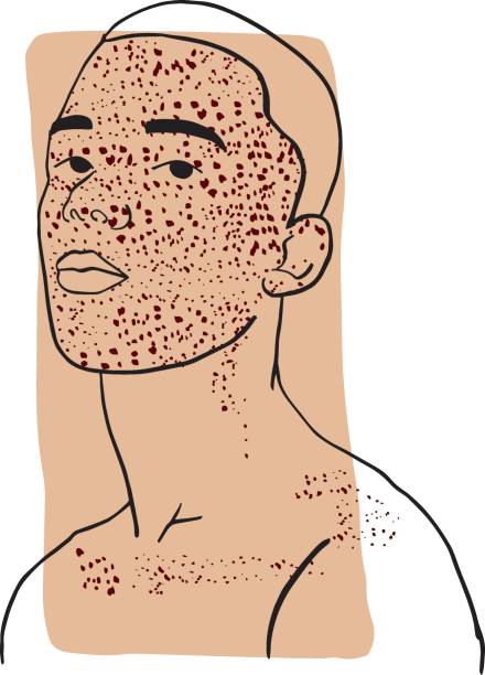 Hand-draw outline portrait of a young man with his face cover by freckles and dark beige sample color Hand-draw outline portrait of a young man with his face cover by freckles and dark beige sample color. Abstract colletion of different people and skin tones. Diversity concept freckle stock illustrations