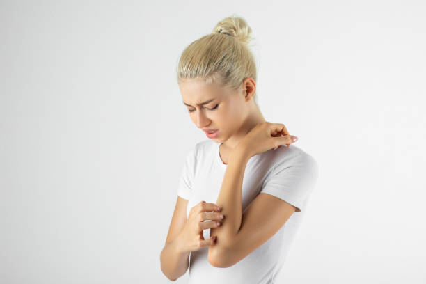 mujer con eczema cutáneo - itchy skin fotografías e imágenes de stock