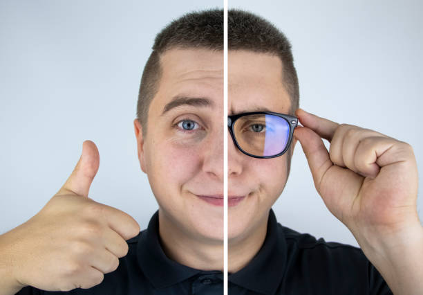 A man with glasses before and after. On one half, the face is happy without glasses, and on the other, a sad expression with glasses. Poor vision treatment concept, laser eye surgery, lens replacement A man with glasses before and after. On one half, the face is happy without glasses, and on the other, a sad expression with glasses. Poor vision treatment concept, laser eye surgery, lens replacement eye surgery photos stock pictures, royalty-free photos & images