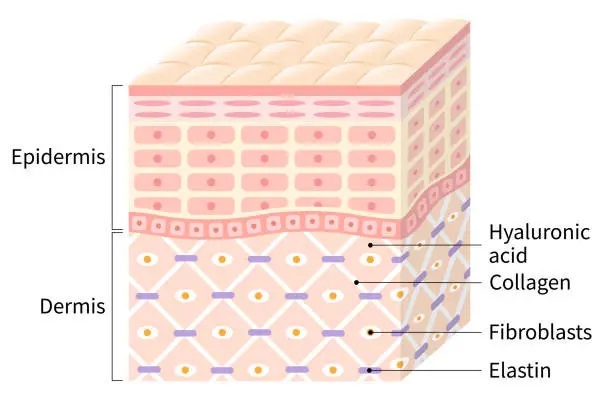Vector illustration of diagram of winkle skin. the collagen framework is broken and wrinkles appears. Beauty skin care concept
