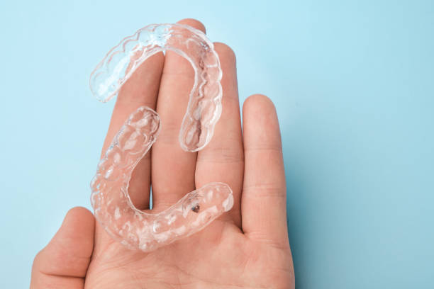 Close up mans hand holding invisible aligners for whitening and straightening of teeth on the blue background. Orthodontic therapy after brackets. Teeth healthcare Close up mans hand holding invisible aligners for whitening and straightening of teeth on the blue background. Orthodontic therapy after brackets. Teeth healthcare. braces stock pictures, royalty-free photos & images