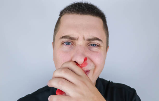 Photo libre de droit de Lhomme A Le Nez Cassé Après Une Bagarre Du ...