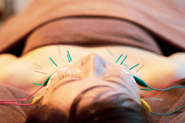 istock Acupuncture to apply an electric current to the face. 1272458481