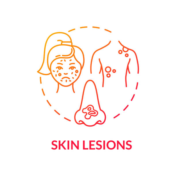 Skin lesions concept icon Skin lesions concept icon. Dermatology. Skin moles and growths. Self examination. Abnormal colored epidermis idea thin line illustration. Vector isolated outline RGB color drawing leprosy stock illustrations