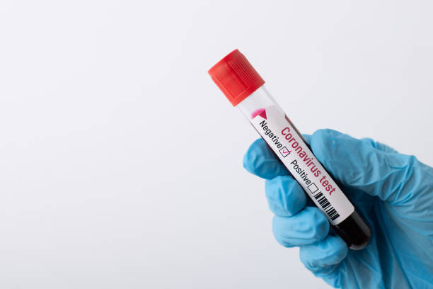 medical worker holding blood specimen in hand. - blood sample imagens e fotografias de stock