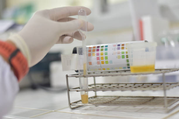 Urinalysis in laboratory. Urinalysis in laboratory. specimen holder stock pictures, royalty-free photos & images