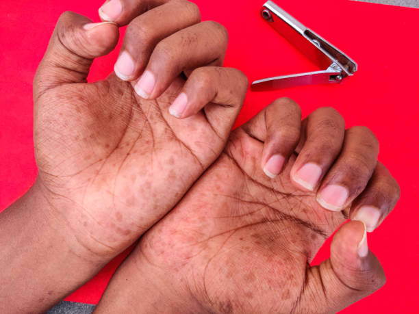istock South Indian man showing both the hands with nails in his fingers. Ready to cut nails using nail cutter. Isolated on red background 1272822430
