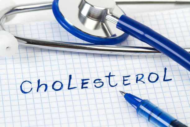 A blue stethoscope on a paper with cholesterol word write in it