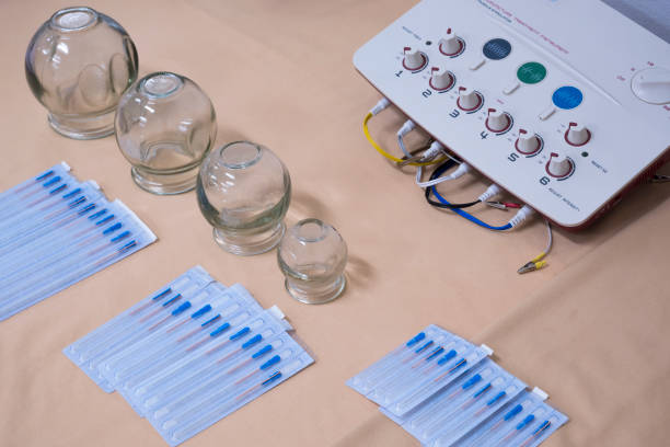 Medical cupping glass and various needles with nerve and muscle stimulator on tablecloth for acupuncture treatment in hospital room Medical cupping glass and various needles with nerve and muscle stimulator on tablecloth for acupuncture treatment in hospital room electric cupping therapy stock pictures, royalty-free photos & images