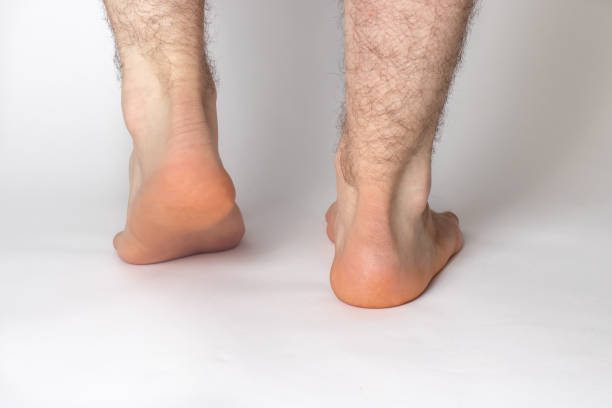 흰 배경에 벌거 벗은 털이 남성 다리, 발, 발 뒤꿈치. 아킬레스 건. - reflexology beauty naked human foot 뉴스 사진 이미지