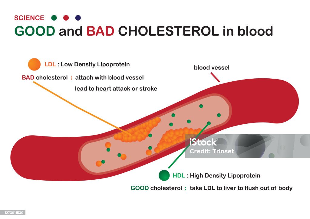 Science Diagram Show Good And Bad Cholesterol In Blood Vessel As Plaque