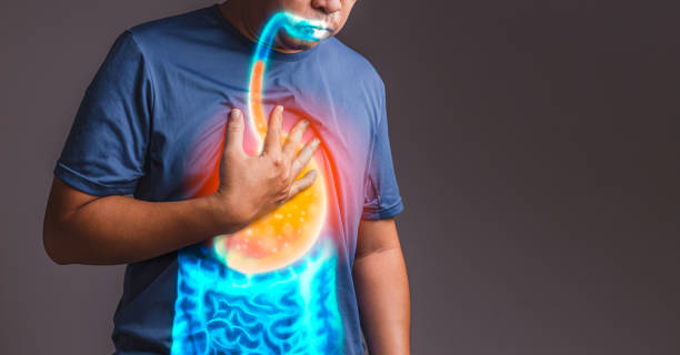 gastroesophageal reflux disease (GERD) gastroesophageal reflux disease (GERD) heartburn photos stock pictures, royalty-free photos & images