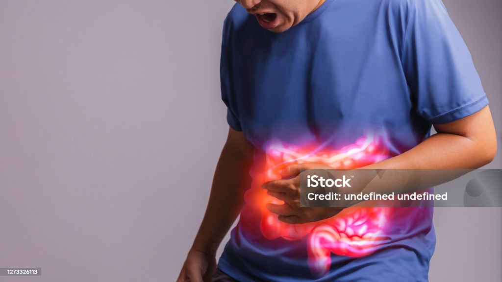 Irritable Bowel Syndrome (IBS)., x-ray concept. Irritable Bowel Syndrome Stock Photo