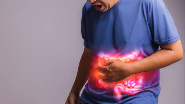 Irritable Bowel Syndrome (IBS)., x-ray concept. Irritable Bowel Syndrome (IBS)., x-ray concept. irritable bowel syndrome stock pictures, royalty-free photos & images