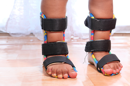 Child cerebral palsy disability, legs orthosis