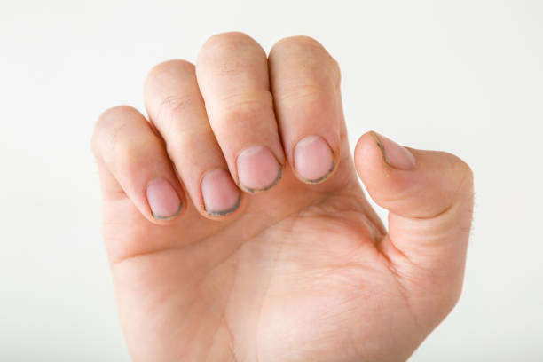 istock Young man hand with dirty nails isolated on light gray background. Closeup. Front view. 1273435640