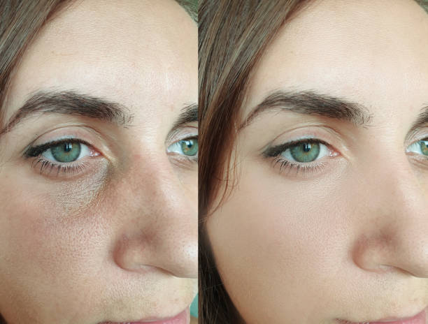 istock woman face wrinkles before and after treatment collage 1273451054