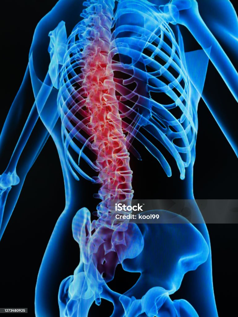 Human spine health Backache Stock Photo