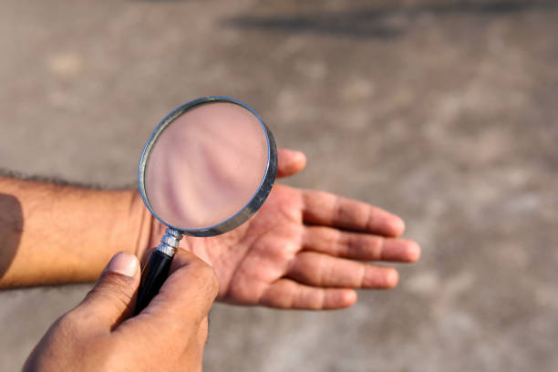 istock Man checks hand with magnifying glass 1273701495