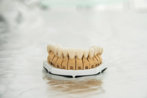 Qualified anatomic zirconia crown of mandibular molar close up macro isolated on black background. The concept of aesthetic dentistry.