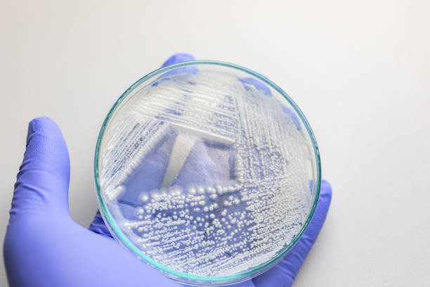 istock Yeast in petri dish, Microbiology for education in laboratories. 1273829055