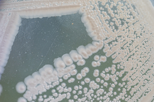 Yeast in petri dish, Microbiology for education in laboratories.